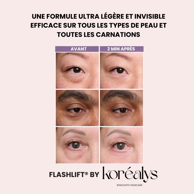 2 FLASHLift® Contour des yeux effet lift instantané       (8–12h)
