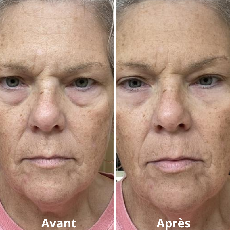 FLASHLift® Contour des yeux effet lift instantané