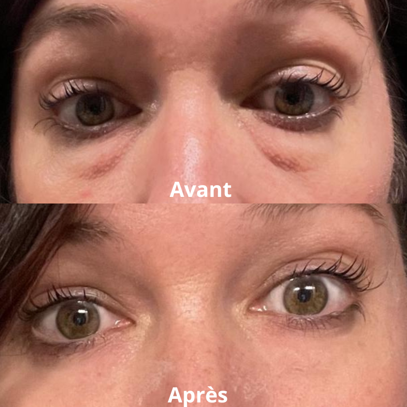 2 FLASHLift® Contour des yeux effet lift instantané       (8–12h)