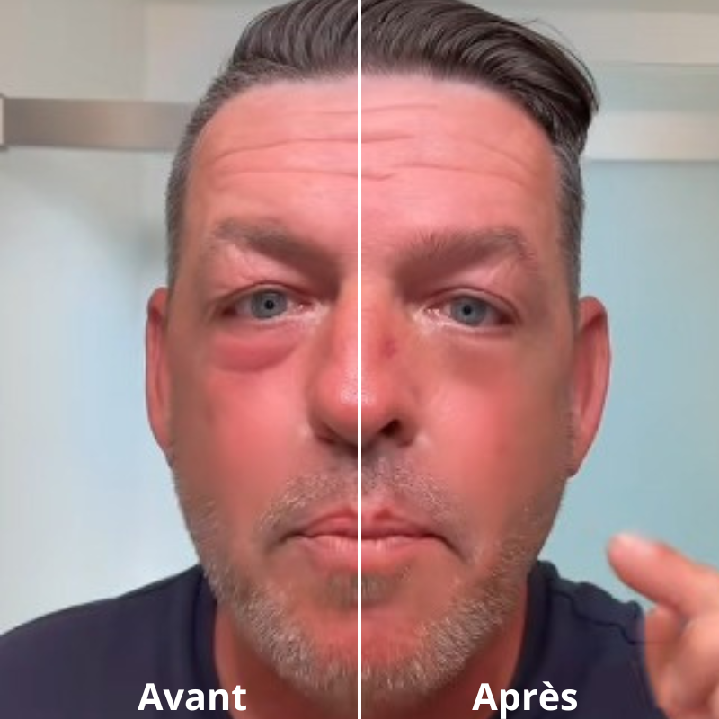 2 FLASHLift® Contour des yeux effet lift instantané       (8–12h)