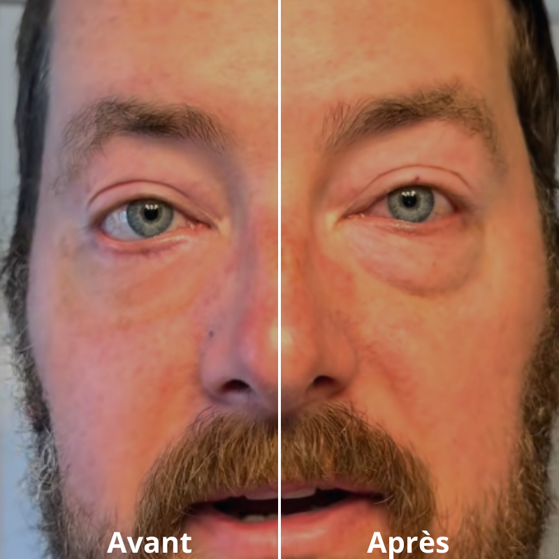 2 FLASHLift® Contour des yeux effet lift instantané       (8–12h)